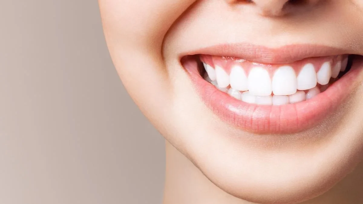 Benefits of Professional Teeth Whitening